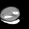 SPORK, NICO - 22.03.1976 - 02.08.2022 - CT obere Extremität - 17:56:57